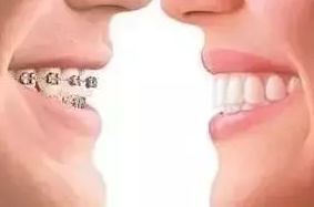 問診室：關(guān)于正畸，不止你想的這么簡單喔