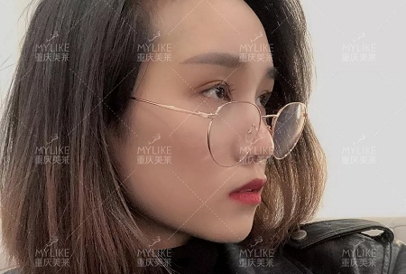 自體脂肪+雙眼皮，這對(duì)cp你不pick一下嗎？