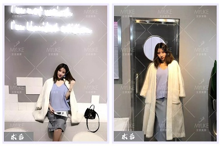 顏值：修復(fù)后的雙眼，美瞎一路