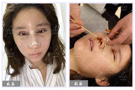 顏值：修復(fù)后的雙眼，美瞎一路