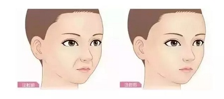 問診室：你說脂肪壓得你好累，殊不知它也可以是寶貝