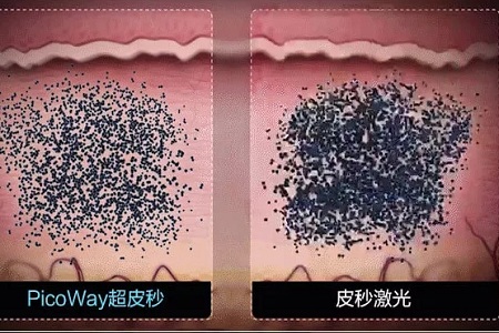 美萊實驗室：據(jù)統(tǒng)計90%的長斑都與夏天這一東西有關，你臉上的斑點是嗎？