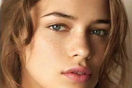 美萊實(shí)驗(yàn)室 | 雀斑還能這樣祛？雀斑女孩看過來