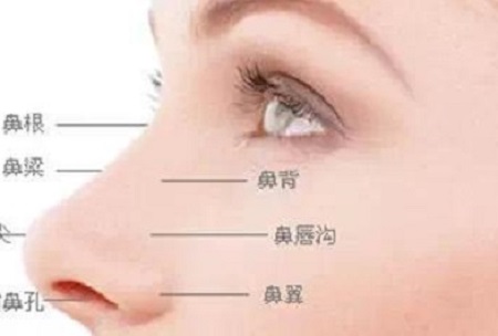 鼻翼整形