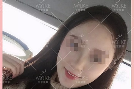 顏值日志 | 鼻子對整體顏值的改變有多大？