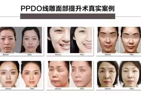 關于*雕，你想了解的都在這里！