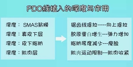 關于*雕，你想了解的都在這里！