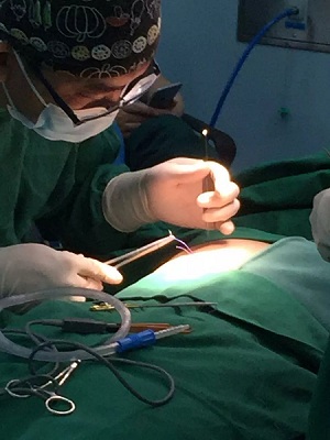 關(guān)于鼻整形修復(fù)，你需要知道的