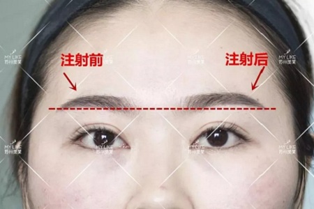 想要歐式大眼，一定要注意與這個部位協(xié)調(diào)！