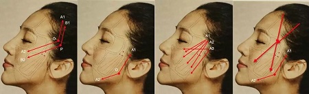 做完*雕斷線了！應(yīng)該怎么辦？