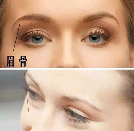 全切？埋線？韓式三點(diǎn)雙眼皮？選擇那種比較好？