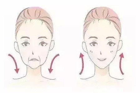 同樣是填充玻尿酸，效果為什么不同