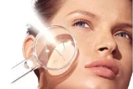 夏天那么曬，這個(gè)時(shí)候做祛斑真的靠譜嗎？