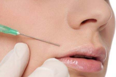 鄭州美萊整形除皺針效果好不好？