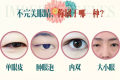 鄭州美萊整形雙眼皮多少錢？