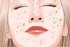 鄭州美萊超皮秒祛斑好嗎？