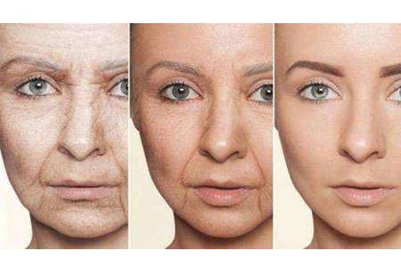 <a href='/zz/' target='_blank'><u>鄭州美萊</u></a>整形醫(yī)院除皺方式有哪些？