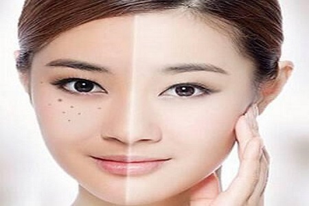 廣州美萊彩光嫩膚美白多少錢