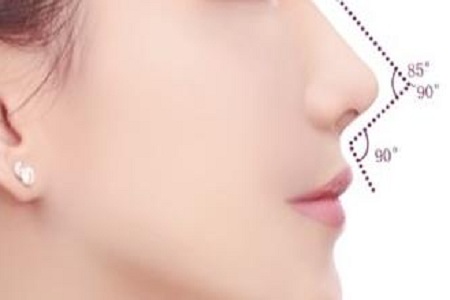 假體隆鼻什么材質(zhì)好?術后恢復要多久?