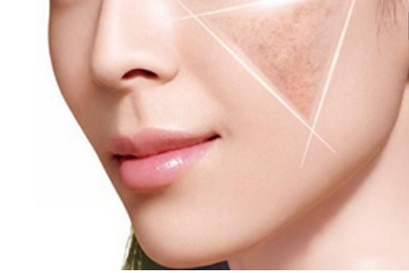 佛山祛斑效果好嗎？注意這幾點(diǎn)就好了