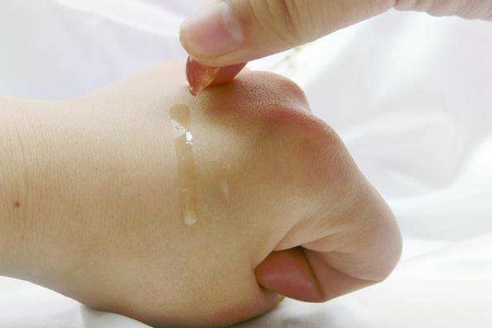 祛斑方法有哪幾種？這些祛斑小妙招你需要掌握