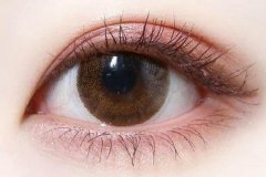 貴陽(yáng)雙眼皮手術(shù)好不好