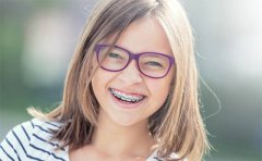 牙齒矯正帶牙套要多少錢，一般要帶多久才好，正畸期間注意事有哪些