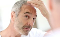 種植發(fā)際線一般多少錢啊，2023植發(fā)一覽價(jià)格表