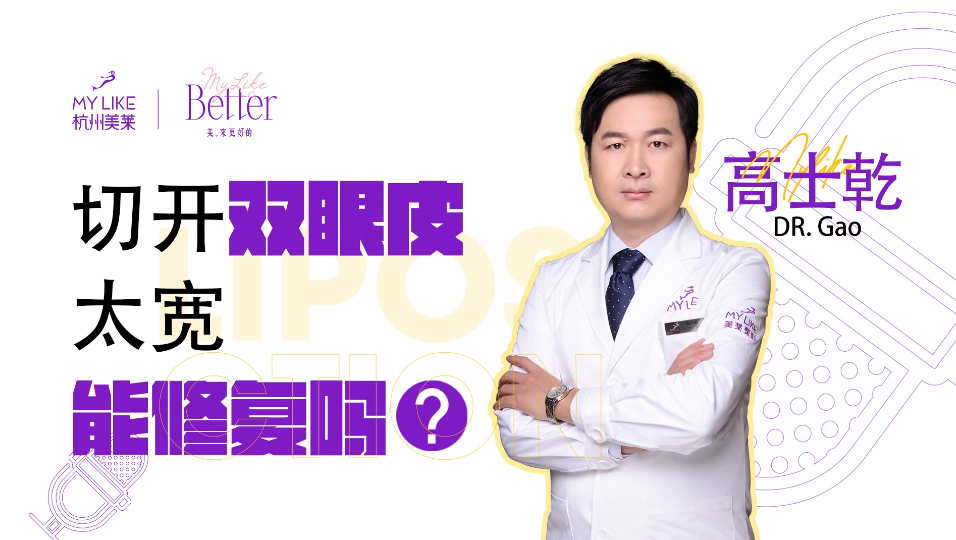 杭州美萊：切開雙眼皮太寬能修復(fù)嗎？