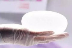 南京做進(jìn)口假體隆胸需要多少錢