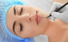 假體墊下巴大概需要多少錢，貴陽、寧波、福州價(jià)格參考