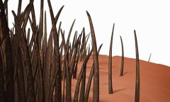 發(fā)際線后移做植發(fā)手術(shù)有用嗎，需要多少錢