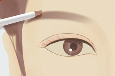 眉毛種植手術過程是怎樣的，多久能看到效果