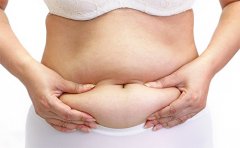 腹部抽脂會(huì)反彈嗎有危害嗎，揭秘抽脂價(jià)格表