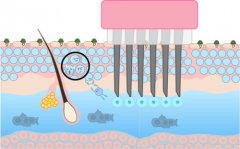 法令紋、色斑、紅血絲、暗沉，美萊醫(yī)生教你三維亮膚法