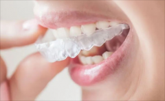 上海牙齒正畸有必要嗎，多少錢(qián)