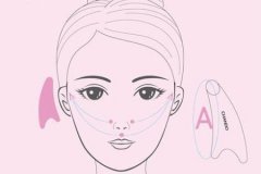 重慶整形醫(yī)院做自體脂肪豐太陽(yáng)穴效果如何，術(shù)后注意什么