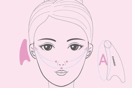 自體脂肪豐太陽穴效果