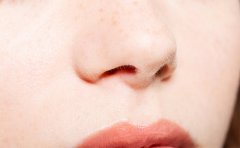 鼻翼縮小術(shù)大概需要多少錢，恢復(fù)期多久附注意事項(xiàng)