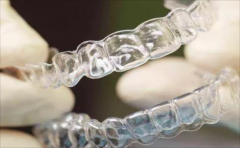 隱形正畸麻煩嗎，影響吃飯嗎