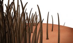 昆明發(fā)際線種植哪個醫(yī)院效果好，種植多久可以染發(fā)