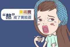 激光真的能去黃褐斑嗎，祛斑價格是多少