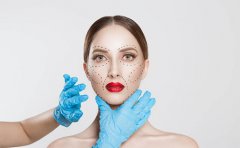 玻尿酸填充法令紋多久可以恢復(fù)自然，注意事項(xiàng)盤點(diǎn)