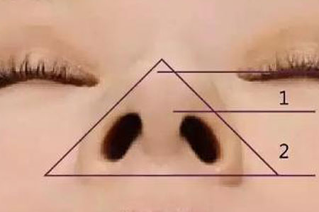 寧波隆鼻醫(yī)院手術(shù)價格表