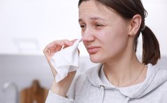 曲靖哪家整形醫(yī)院做隆鼻修復(fù)手術(shù)靠譜，術(shù)后一個(gè)月了還要忌口嗎