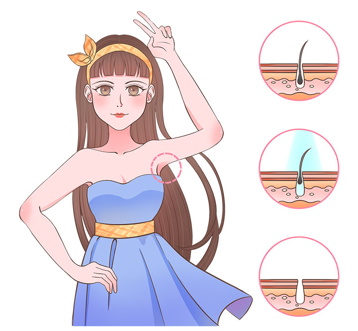 脫毛一般多少錢(qián)