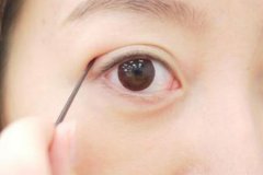 重慶割雙眼皮醫(yī)院手術多少錢，多久能恢復正常