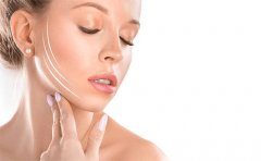 玻尿酸去法令紋需要注意什么，會反彈嗎，價格分享